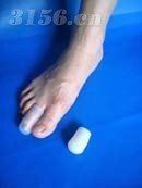 足部护理产品-脚趾套