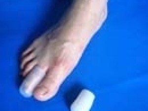 足部护理产品-脚趾套招商
